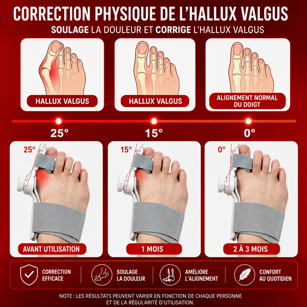 Correcteur Hallux Valgus - Alpha