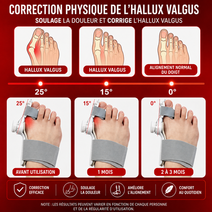 Correcteur Hallux Valgus - Alpha
