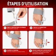 Correcteur Hallux Valgus - Alpha