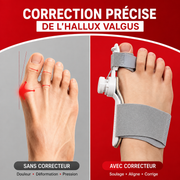 Correcteur Hallux Valgus - Alpha